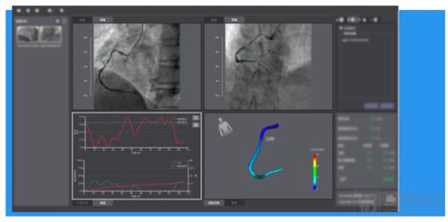 三證齊發(fā),脈流科技心腦血管病功能學評估產(chǎn)品獲nmpa認證